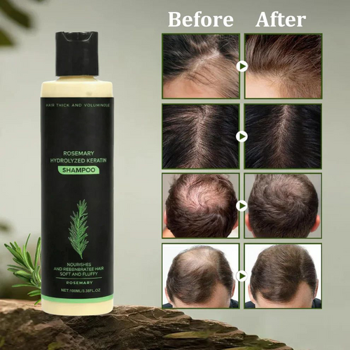 🌱 Organic Rosemary Hair Growth Shampoo