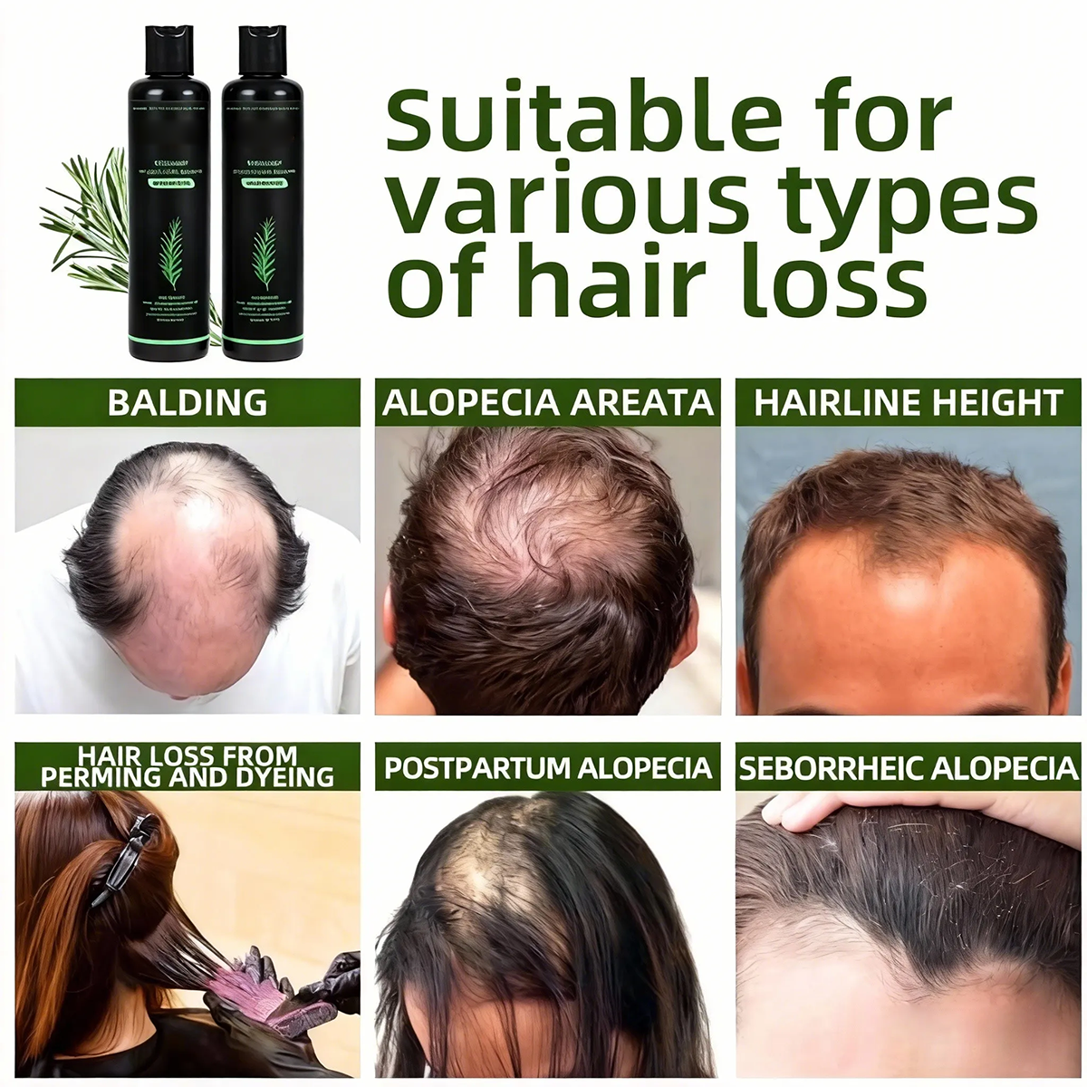 🌱 Organic Rosemary Hair Growth Shampoo