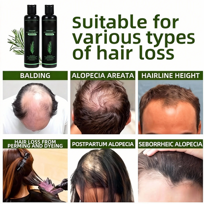 🌱 Organic Rosemary Hair Growth Shampoo