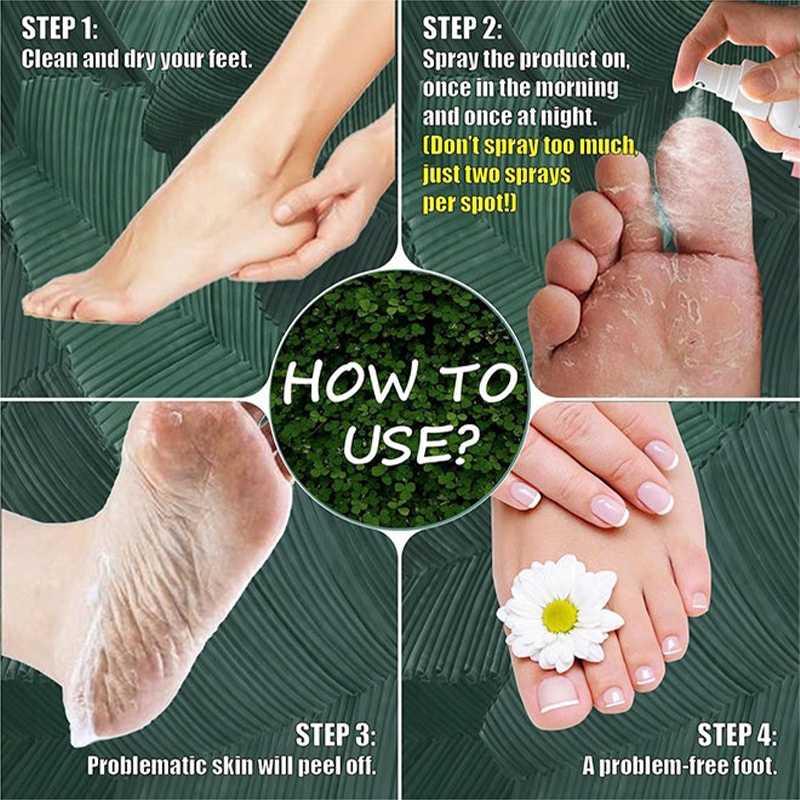 Feet Callus Remover Spray – Rough Skin Softening & Smoothing Foot Care