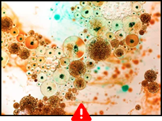 Other Suspended Particles