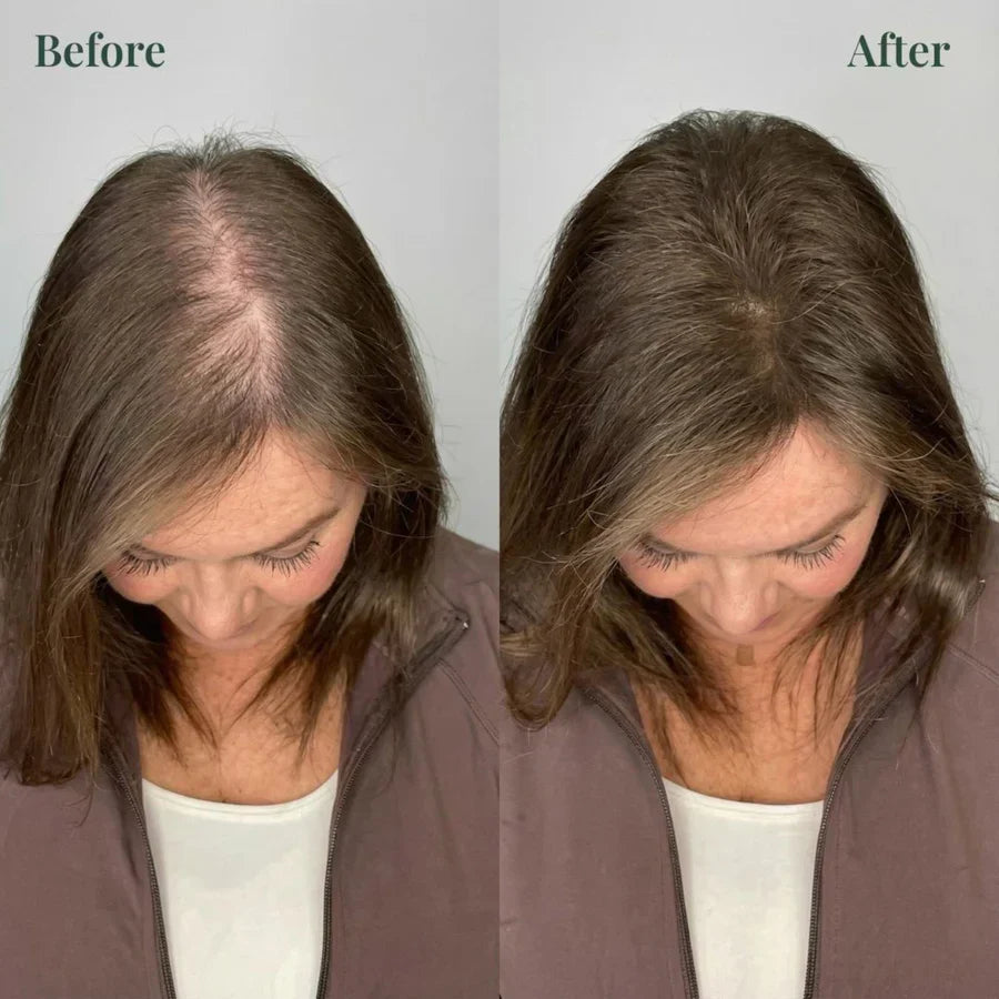🌱 Organic Rosemary Hair Growth Shampoo